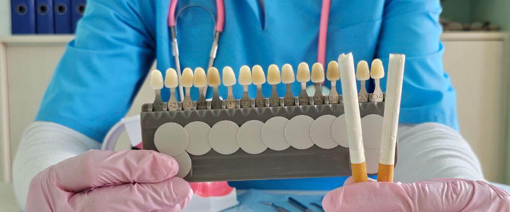 Teeth discoloration due to smoking chart.