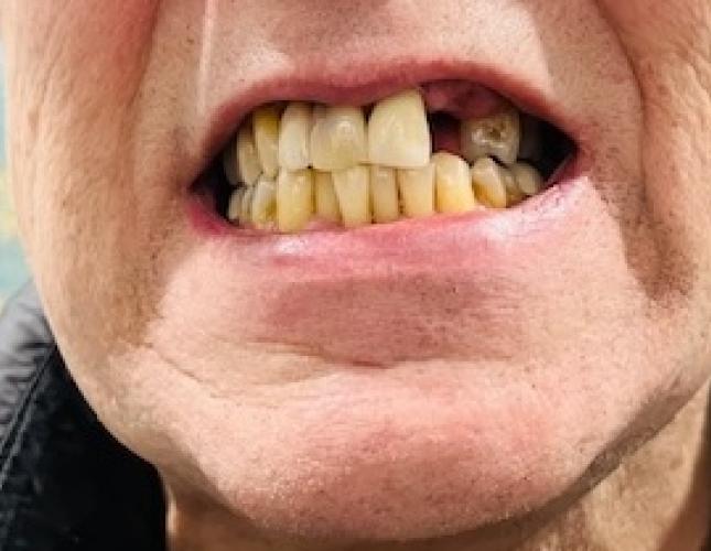 Barb before