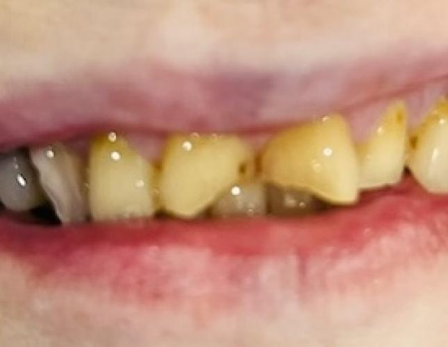 Mary T before