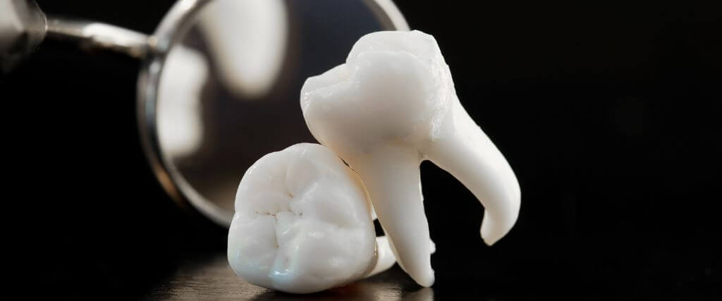 What Is a Deep Dental Cleaning? Understanding Scaling and Root Planing