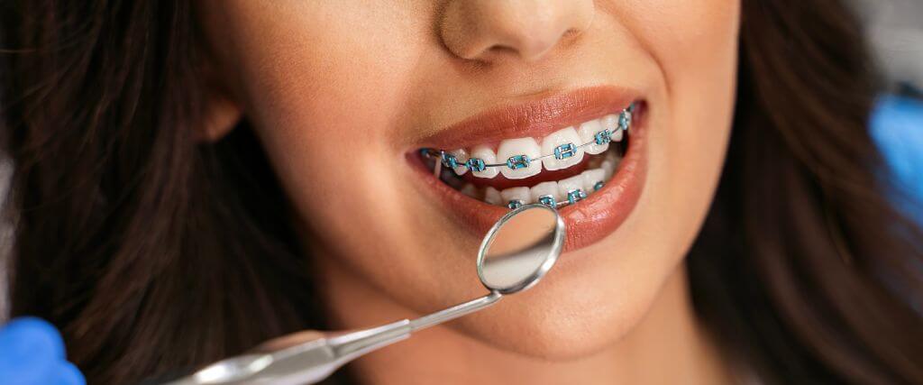 Woman with metal braces